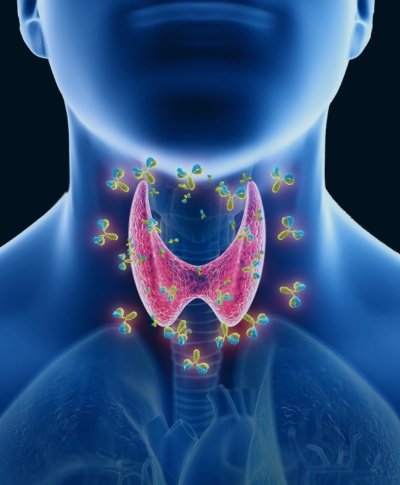 Thyroid disorders and Hashimoto Disease treatment in New York City NYC